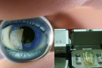 Nhìn mờ, viêm mắt vì kính áp tròng “gian”